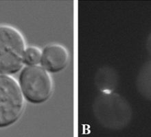 two images in black and white of the same cluster of cells